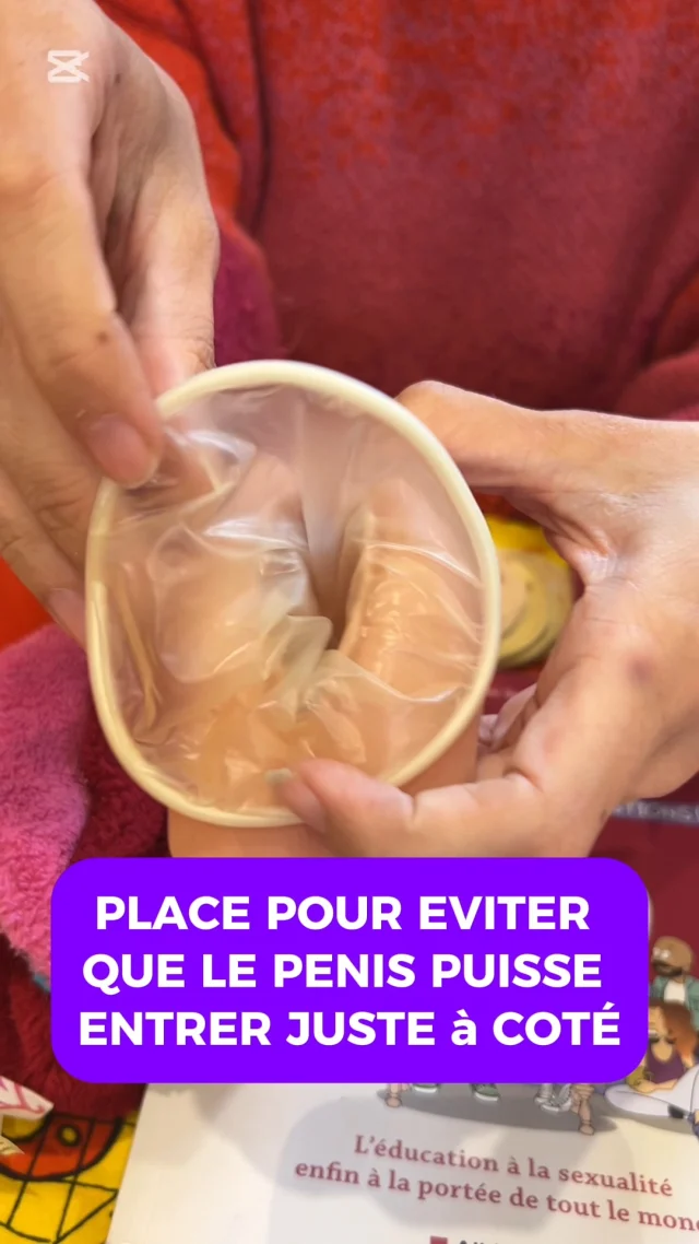 📆 Aujourd'hui, c'est la journée mondiale de la santé ! 
Et demain ... ? Eh bien, c'est le 8 mars, la journée internationale de lutte pour les droits des femmes. Les deux vont de pair !

👊🏾 Parmi les droits, la santé est fondamentale. Chaque femme devrait pouvoir disposer de son corps comme elle le souhaite. 

➡️ Pour ce faire, l'accès à la contraception est essentiel ! Il en existe beaucoup de types mais aujourd'hui, nous avons choisi de faire un focus sur le préservatif interne (aussi appelé Fémidom), encore trop méconnu. 

Le préservatif interne : 
✅ Est sans latex
✅ Peut être posé en avance
✅ Protège aussi les lèvres
❌ Coûte un peu cher (mais possible d'en avoir gratuitement dans des plannings familiaux ou associations)

#protègetoi #droitsdesfemmes #contraception #preservatifinterne #femidom